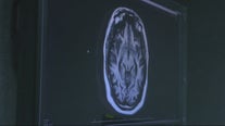 Telestroke services evaluations allow experts to check patients virtually