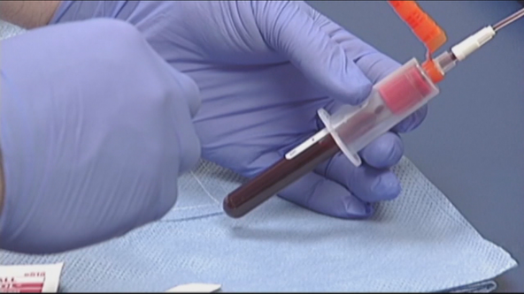 FDA approves new blood test for colorectal cancer screening