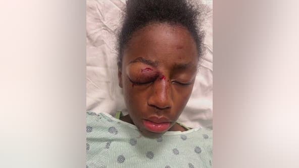 Family calls for justice after 11-year-old Chicago girl brutally beaten in Lawndale