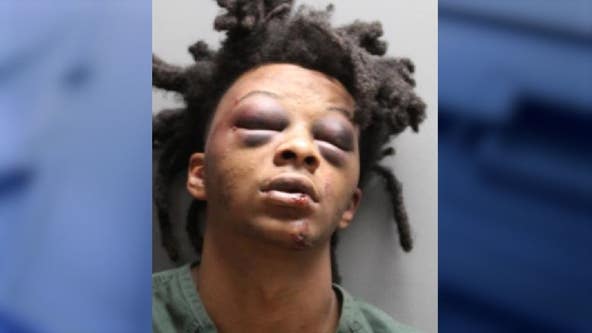 Le’Keian Woods: Graphic video shows bloodied man surrounded by police officers during Florida traffic stop