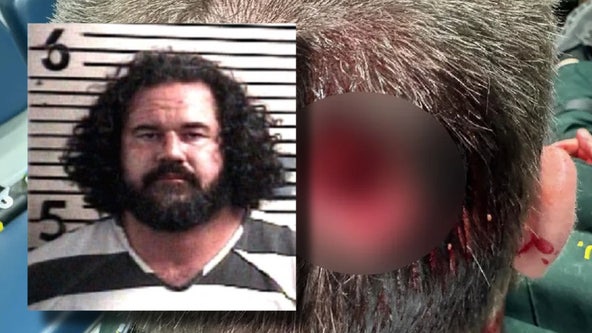 Florida man allegedly bites chunk out of deputy's head at music festival