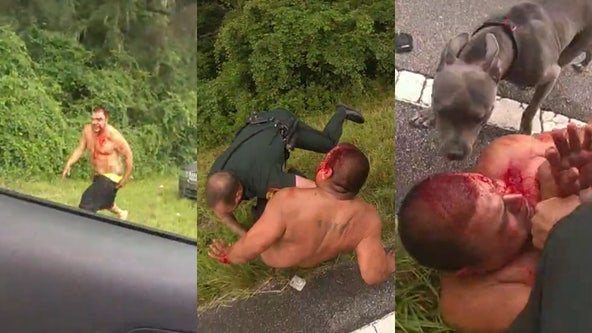 Bloody Florida man allegedly sics pit bull on deputies during chaotic roadside takedown