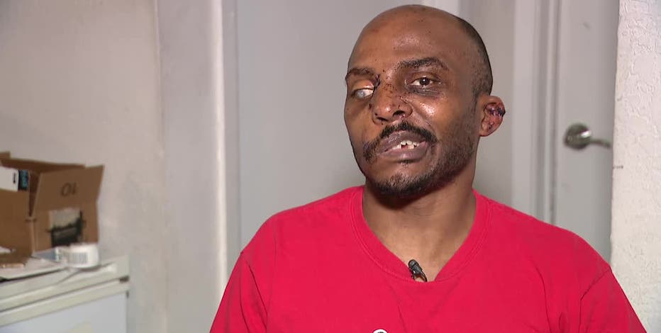 Arlington pit bull owner faces felony charge after dogs mauled neighbor