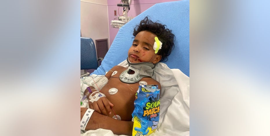 Family of boy hurt in Dallas hit-and-run crash hopes driver involved is caught