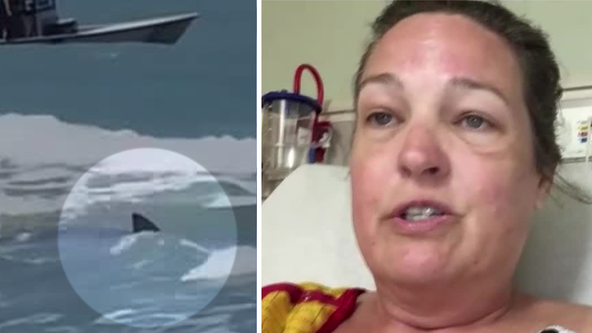 North Texas woman attacked by shark in South Padre: ‘I thought it was a big fish’