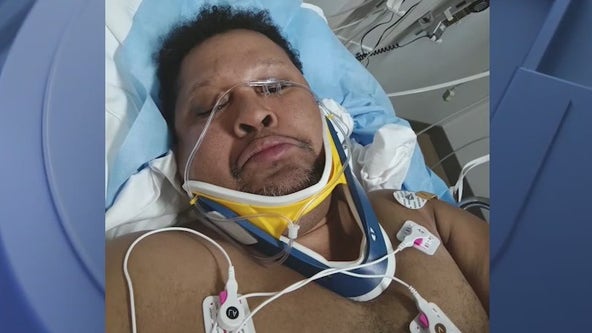 DeKalb County police looking for hit-and-run driver that put motorcyclist in hospital