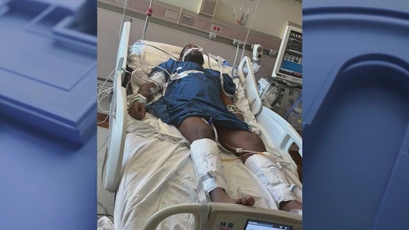 Long recovery ahead for metro Atlanta man hit by stray bullet on Labor Day