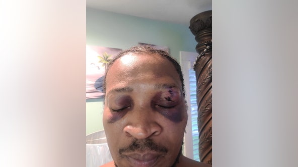 Hall County sheriff responds to man filing lawsuit over alleged assault, releases unedited video