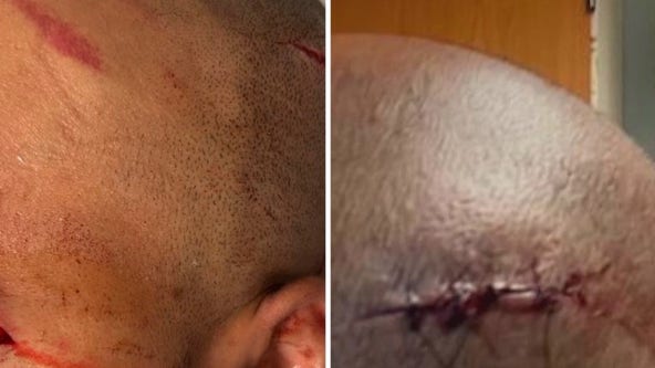 DC employee attacked at youth group home in Laurel
