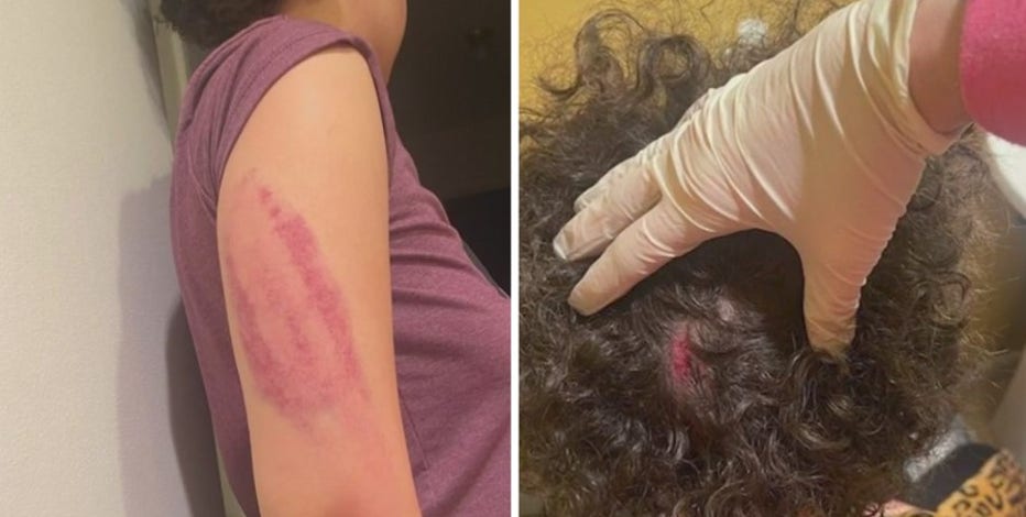 Woman hit with baseball bat outside &pizza on U Street breaks silence