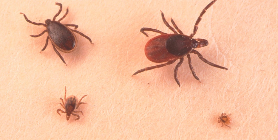 Alpha-gal syndrome: Tick-borne disease that triggers meat allergies is on the rise, CDC says
