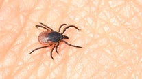 Tick research at Stony Brook Medicine reveals impact on human health