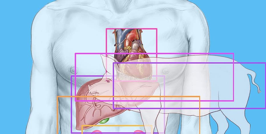 A pig's kidney worked normally in a donated human body for over a month, doctors say