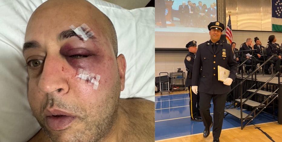 ‘Every New Yorker should be petrified': Uniformed NYPD officer attacked on subway