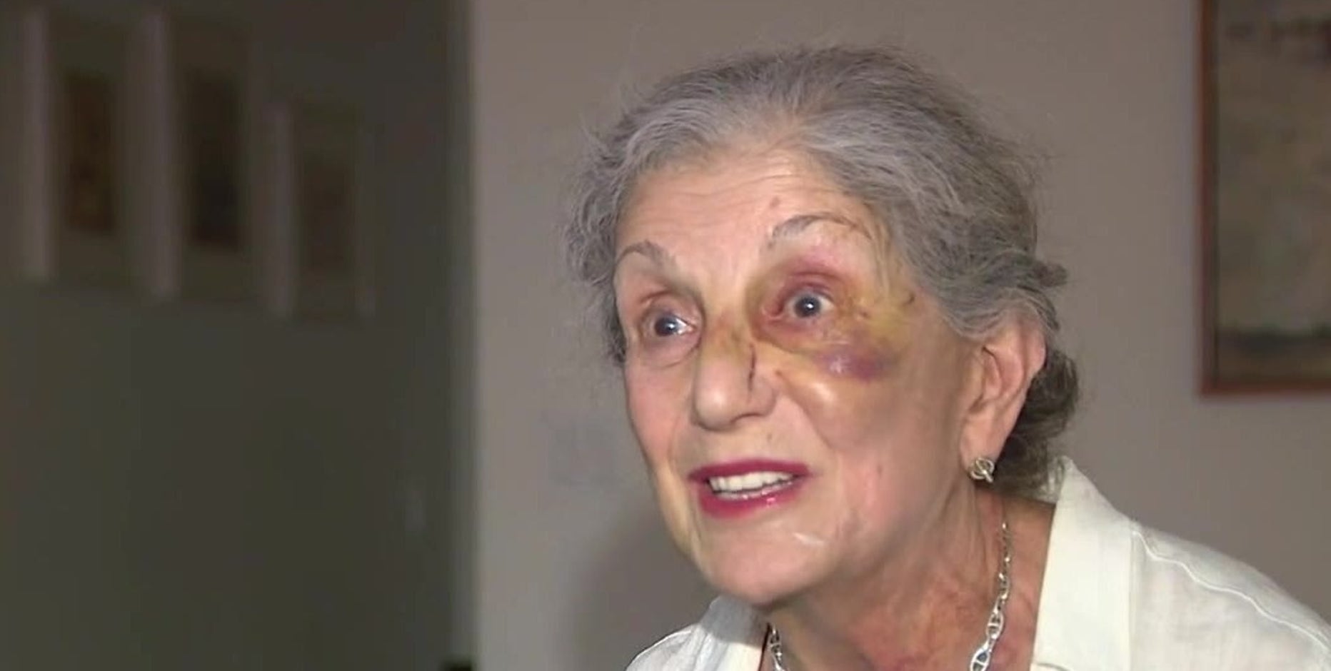 'I feel lucky': Woman, 81, speaks out after random punch in the face