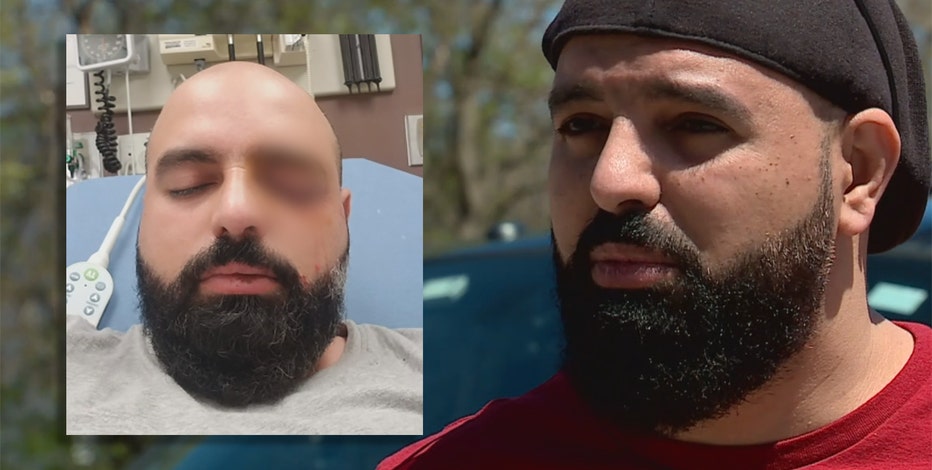 Mask dispute sparks attack, Uber driver hurt in Milwaukee