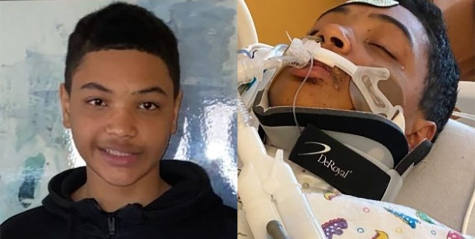 Racine boy shot riding scooter, may never walk again