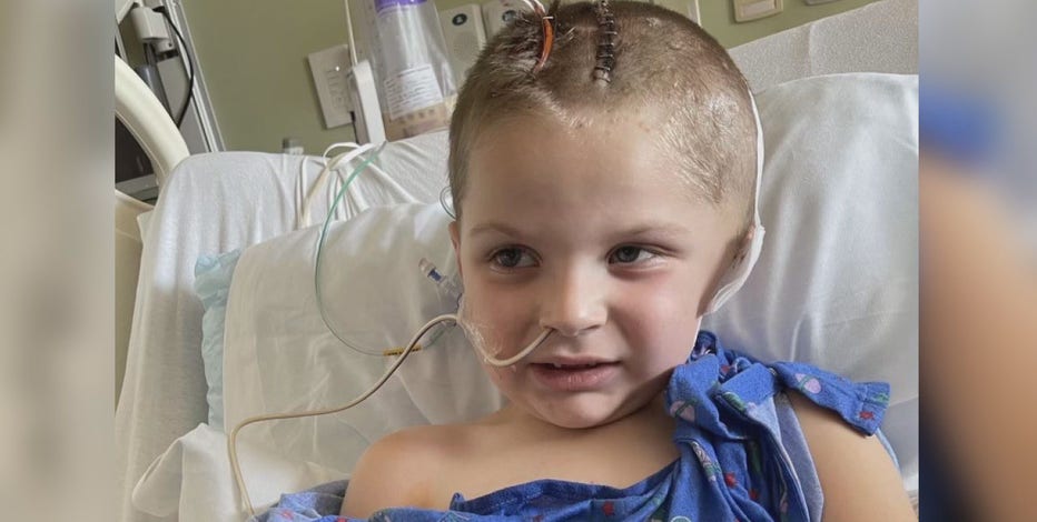 Motorcycle ride benefits boy injured in lawnmower accident
