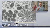 Monkeypox outbreak: Several states declare state of emergency