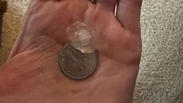 Southeast WI hail stone sizes; severe weather on Tuesday, May 7