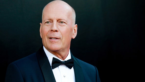 Local neurologist explains actor Bruce Willis' diagnosis of frontotemporal dementia