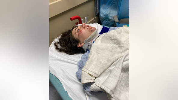 Woman hit by car while riding scooter in Austin; APD not investigating incident as hit-and-run
