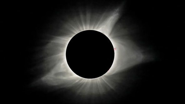 Fake safety glasses left woman with permanent eye damage during 2017 solar eclipse, doctor says