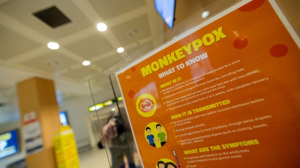 First monkeypox cases reported, Minnesota officials emphasize vaccinations
