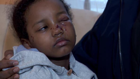 Several dogs attack girl in St. Paul neighborhood