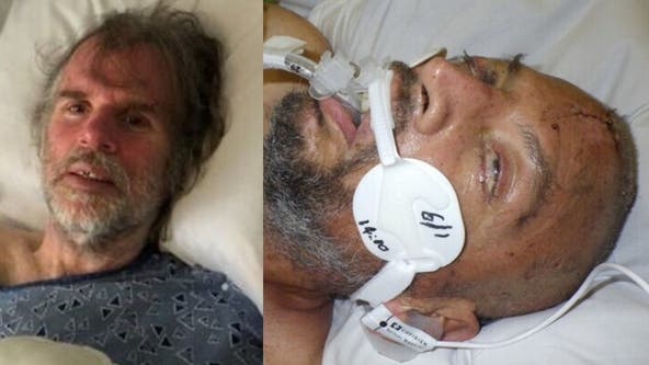 Officials seek help identifying hospital patient in Northridge