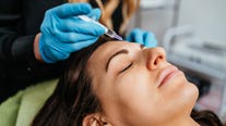 'Vampire facials' at unlicensed spa likely resulted in HIV infections: CDC