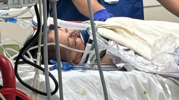 Elderly couple hospitalized after allegedly being attacked by homeless man outside SoCal McDonald's