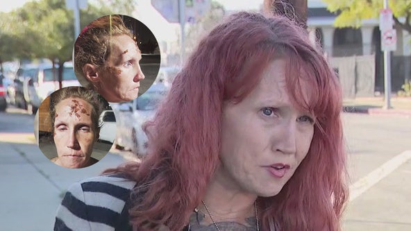 LA mother of 4 seeks public’s help finding hit-and-run driver who left her severely injured