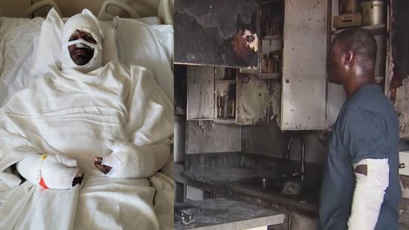 Los Angeles man faces homelessness after fire, home being broken into while hospitalized