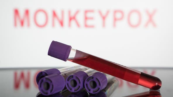 Monkeypox cases in California double in past week