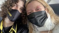 Passenger escorted off flight: Eczema rash possibly mistaken for monkeypox