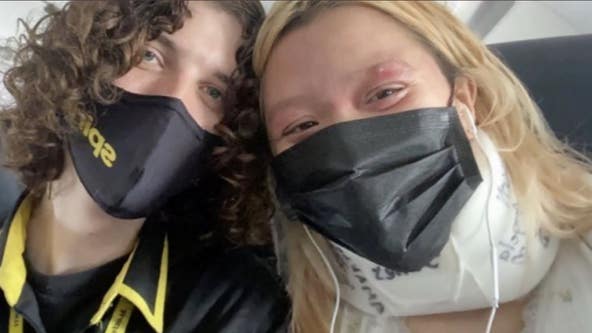 San Francisco native kicked off flight for eczema rash mistaken for monkeypox