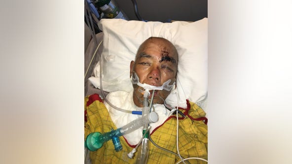 San Leandro police need help identifying man struck by car