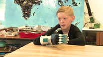 9-year-old boy gets prosthetic hand thanks to South Bay 8th grade tech class