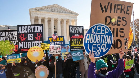 Abortion access 2024: Here’s where the laws stand in your state