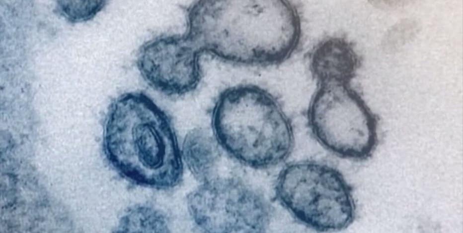 King County reaches CDC's 'yellow' COVID-19 level