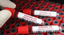 Is omicron leading us closer to herd immunity against COVID-19? Experts weigh in