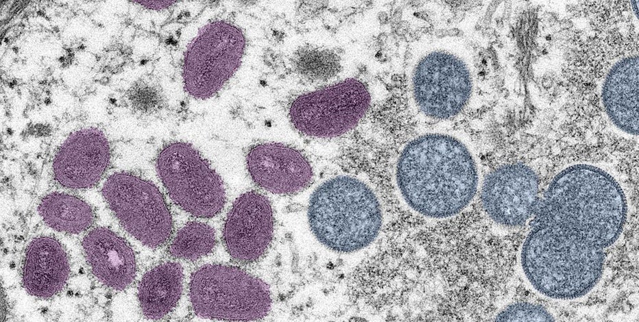Monkeypox in Washington: Cases doubling every week