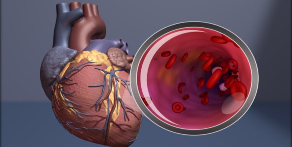 Healthier Together: Understanding heart disease