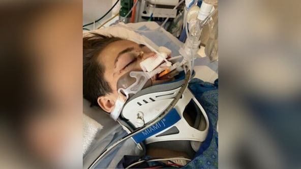 Auburn teen recovering after 'random' shooting in residential neighborhood