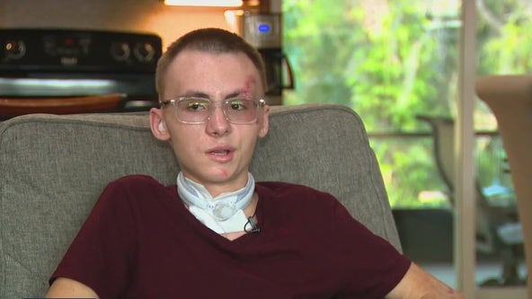 Florida teen on long road to recovery after being hit by car