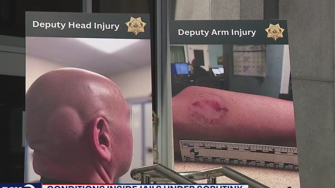 Lack of sunlight at SF jails contributing factor in violence, civil rights attorney says