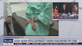 Study finds blood tests can predict tumors years before they form