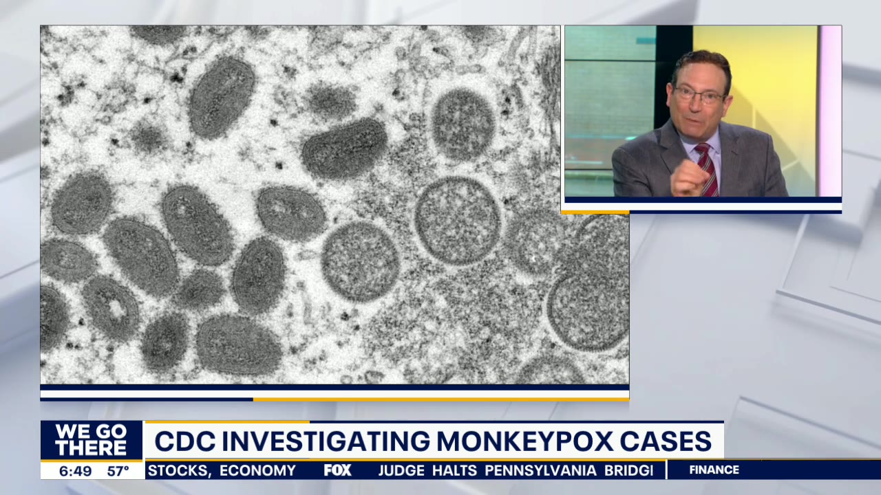 What is monkeypox and what are the symptoms?