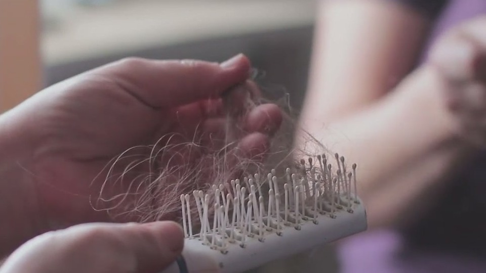 Hair loss: Symptoms and causes